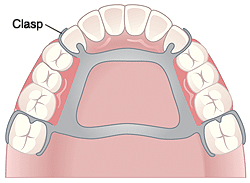 Clasps